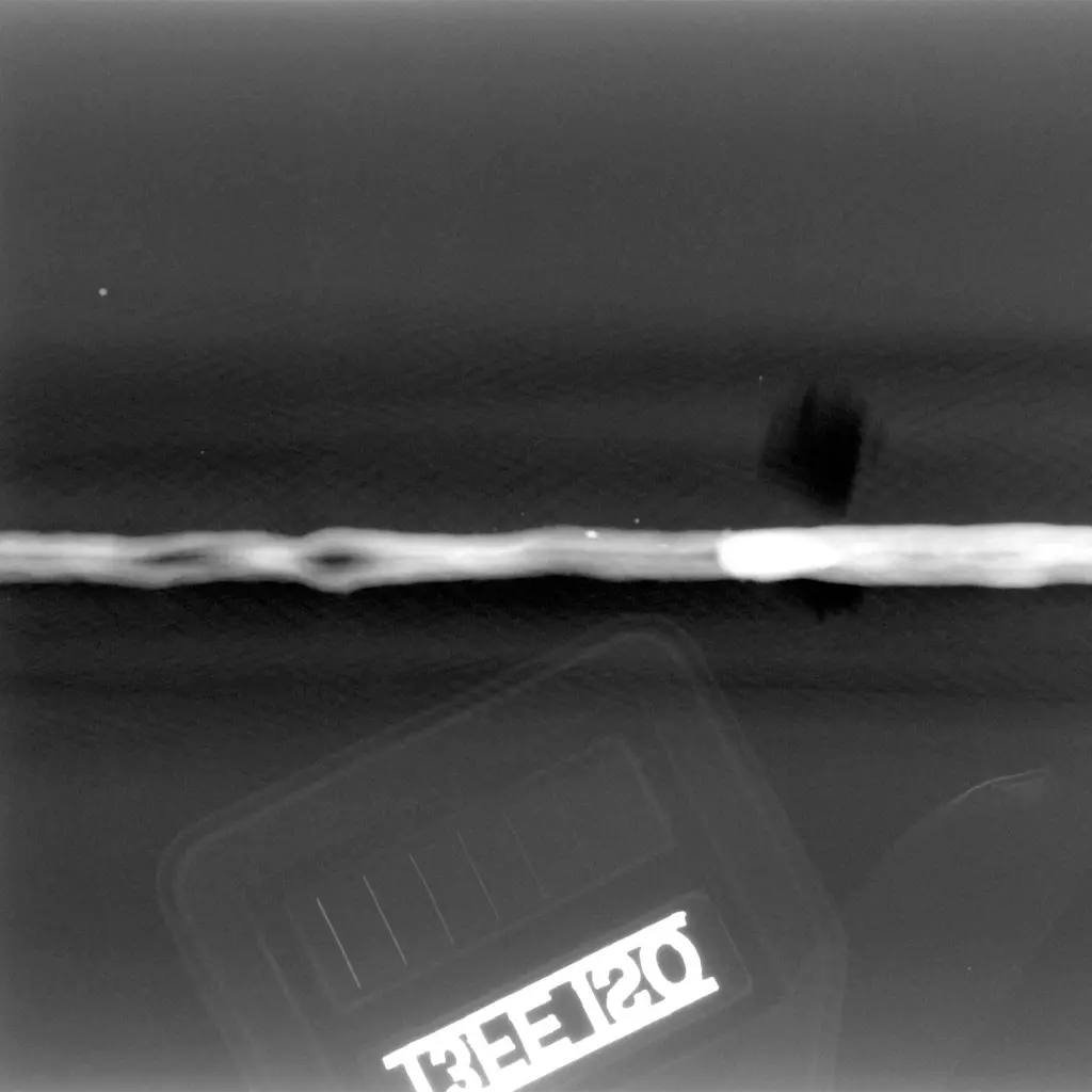 digitized X-ray film